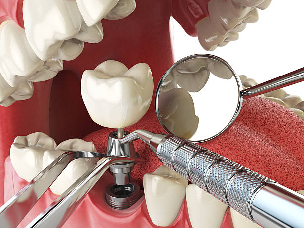 Best Emergency Care for Gum Disease in Williamson, WV