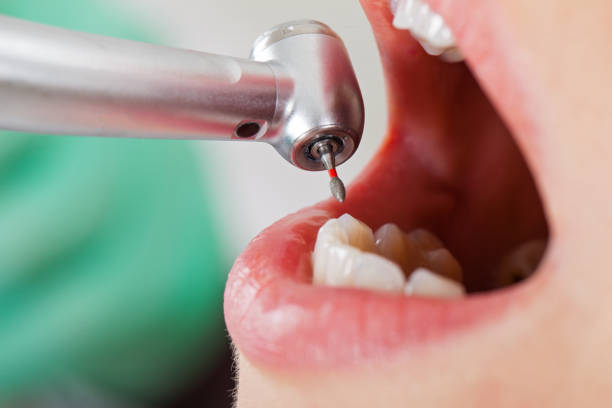 Best Emergency Dental Care for Sports Injuries in Williamson, WV